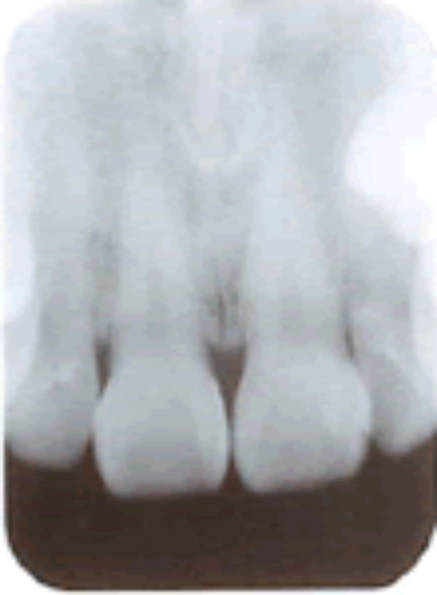 正常な歯周組織のＸ線写真